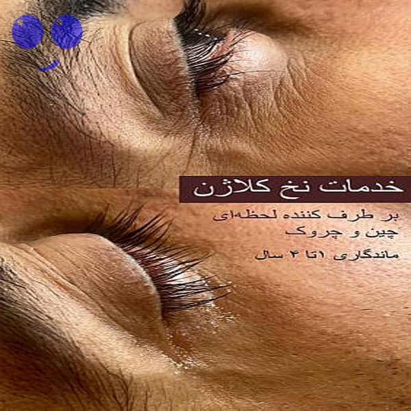 نخ کلاژن جذبی 4 نخ کلاژن جذبی