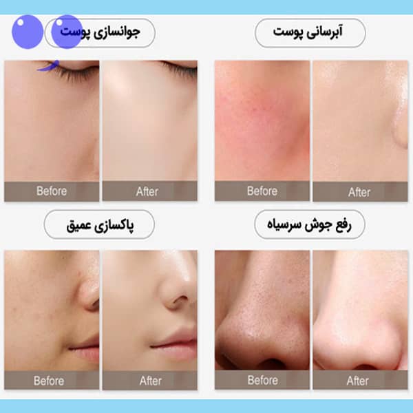 دستگاه هیدروفیشیال 8 کاره پلاژن دار دراگون 6 دستگاه هیدروفیشیال 8 کاره پلاژن دار دراگون