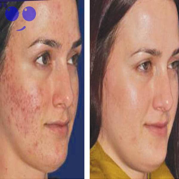 کوکتل ضدلک وروشن کننده Sws برند ژنوسیس 6 کوکتل ضدلک وروشن کننده sws برند ژنوسیس