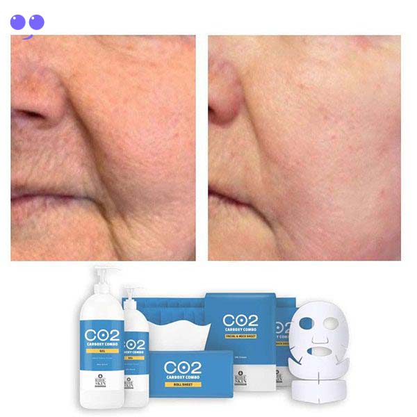 ژل کربوکسی ریب اسکین 750 میلی لیتر 5 ژل کربوکسی ریب اسکین 750 میلی لیتر