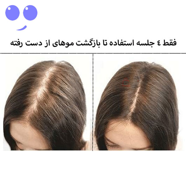 کوکتل ضد ریزش و تقویت ریشه مو کلین بیوتی 10 میل 5 کوکتل ضد ریزش و تقویت ریشه مو کلین بیوتی